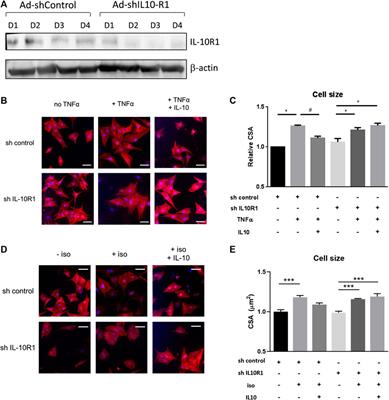 Signaling via the Interleukin-10 Receptor Attenuates Cardiac Hypertrophy in Mice During Pressure Overload, but not Isoproterenol Infusion